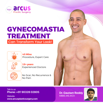Gynecomastia Treatment in Hyderabad | Liposuction Treatment in Hyderabad