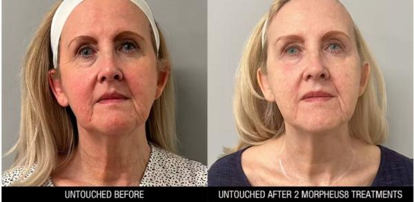 Weight loss Valley medical