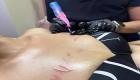 3D Areola Tattoo Sonoma