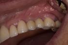 Trusted Dental Clinic in Tijuana – Comprehensive Care for a Brighter, Healthier Smile
